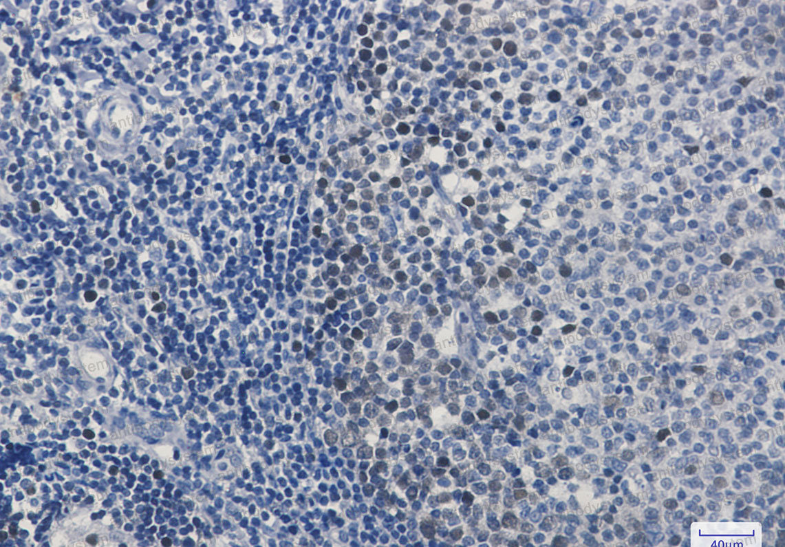 Валидация AntibodySystem RHD64701