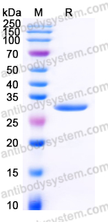 EHK47501, SDS-PAGE