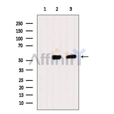 Валидация Affinity AF6005 - 3190