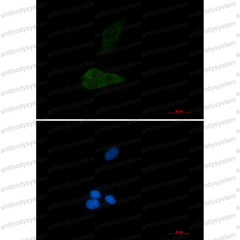 Валидация IF - AntibodySystem RHN78701