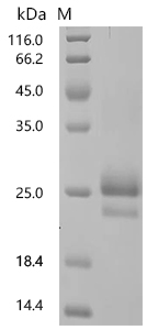 SDS-PAGE