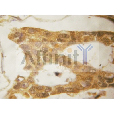 Валидация Affinity AF5004 - 2432