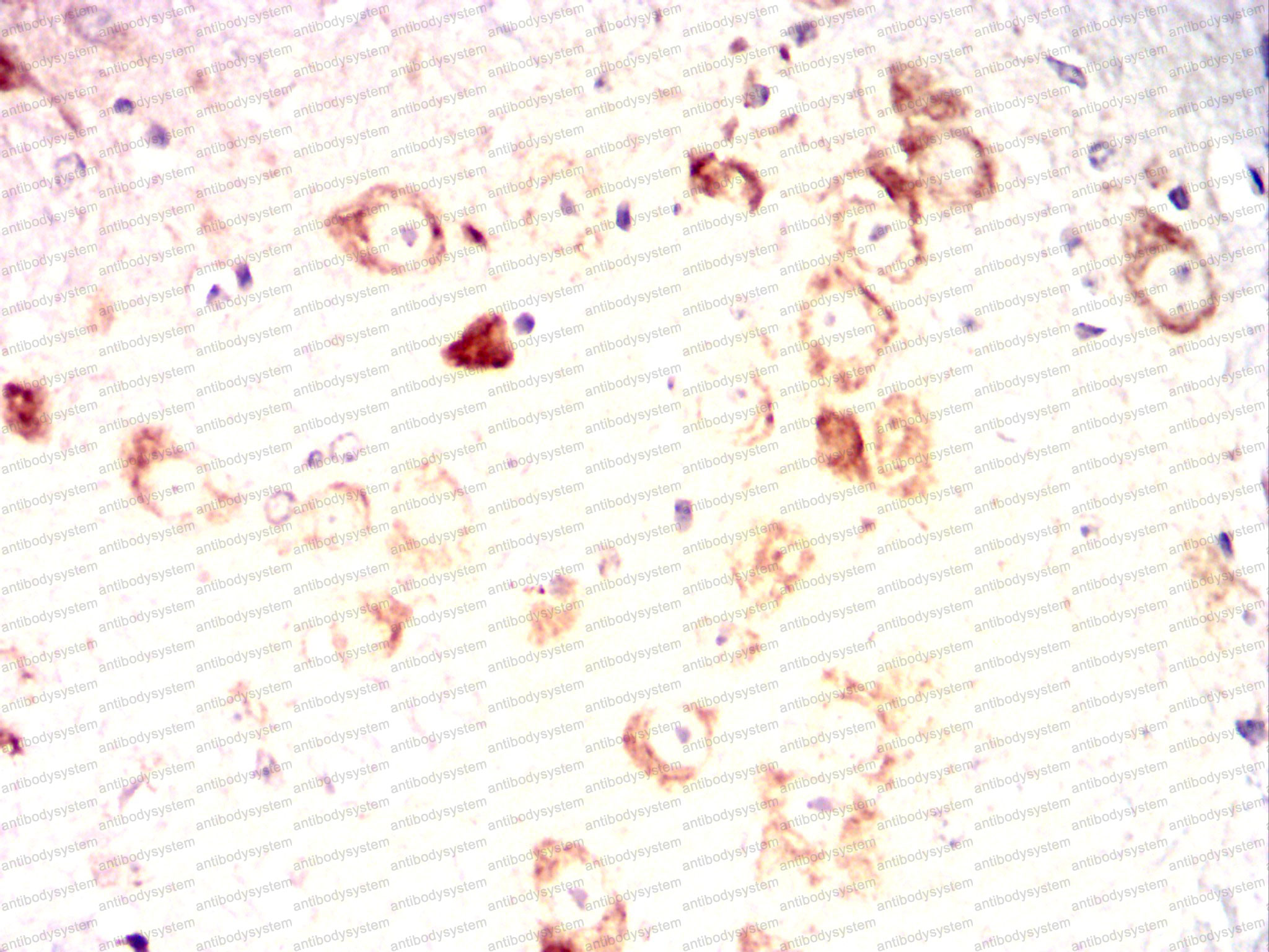 Валидация AntibodySystem RHC84902 (1113)