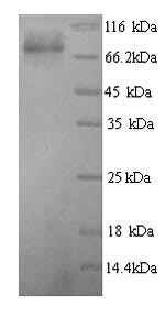 SDS-PAGE