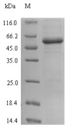 SDS-PAGE