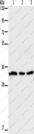 Вестерн-блоттинг, GPA33, клетки 293T, 231 и ткань колоректального рака человека