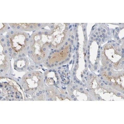 Валидация Affinity DF6894 - 18488