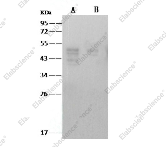 Вестерн-блоттинг, SARS-CoV Nucleoprotein/NP, рекомбинантный белок