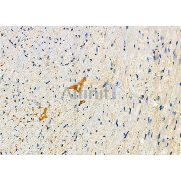 Валидация Affinity DF8707 - 20701