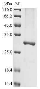 SDS-PAGE