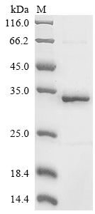 SDS-PAGE