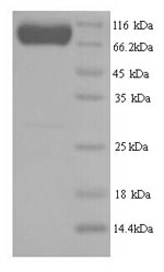 SDS-PAGE