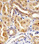 Валидация AssayVector ARM2114(3370)