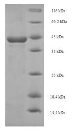 SDS-PAGE