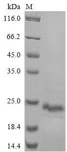SDS-PAGE