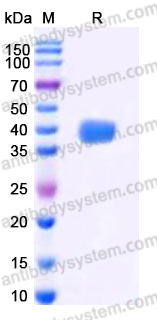 EHD89701, SDS-PAGE