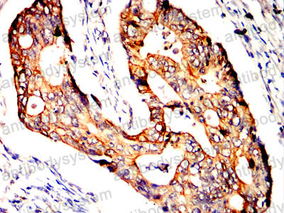 Валидация AntibodySystem RHF90005