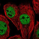 Валидация AssayVector ARM2083(3262)