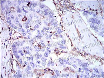 Валидация AntibodySystem RHF46106