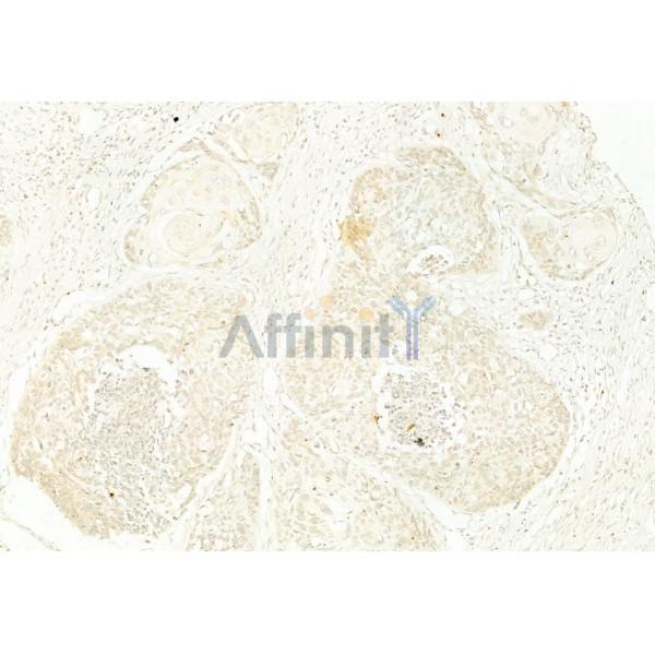 Валидация Affinity DF6304 - 17621