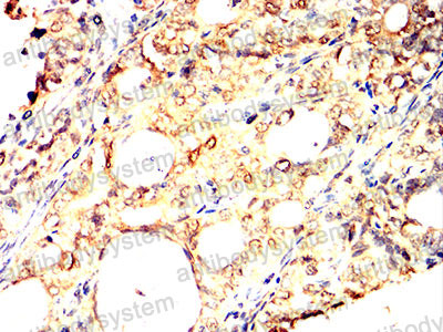 Валидация AntibodySystem RHN87402 (3910)