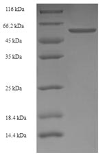 SDS-PAGE