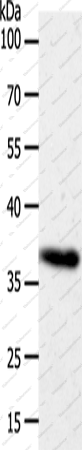 Вестерн-блоттинг, AKR1B1, клетки HeLa