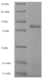 SDS-PAGE