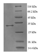 SDS-PAGE