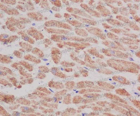 Валидация AntibodySystem RHC96401