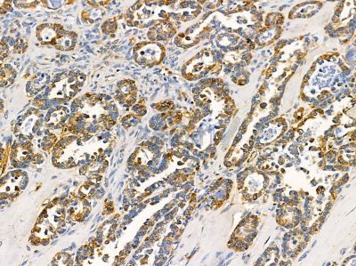 Валидация Affinity DF14380 - 10304