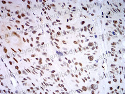 Валидация AntibodySystem RHA88904