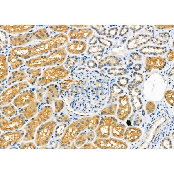 Валидация Affinity DF6889 - 18479