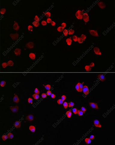 Иммунофлуоресценция, NMDAR1, клетки Neuro-2a
