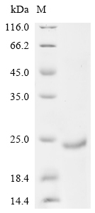 SDS-PAGE