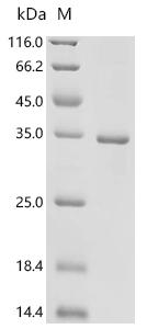 SDS-PAGE