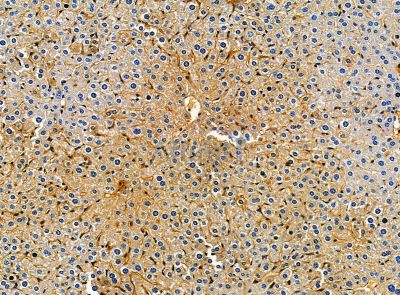 Валидация Affinity DF14242 - 10092