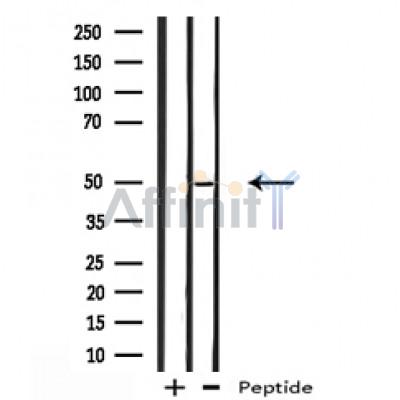 Валидация Affinity DF12139 - 6312