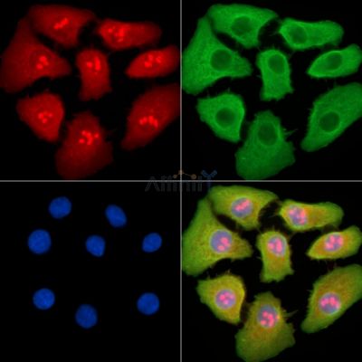 Валидация Affinity DF14258 - 10113