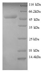 SDS-PAGE