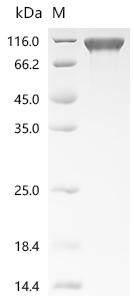 SDS-PAGE