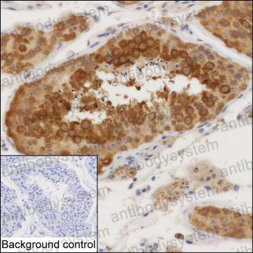 Валидация AntibodySystem RHB71703