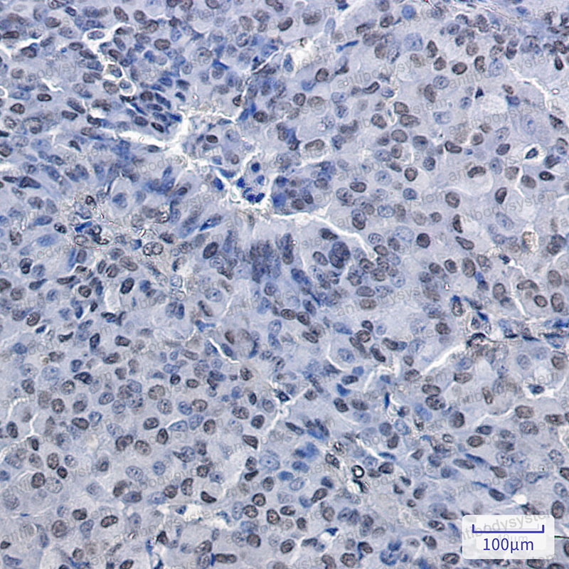 Валидация AntibodySystem RHN32001