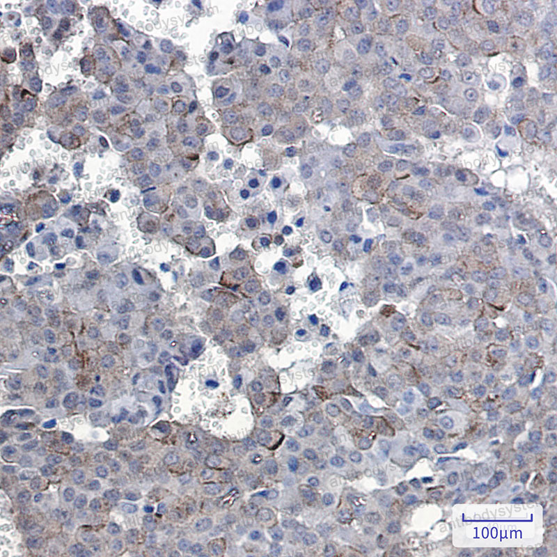 Валидация AntibodySystem RHB86911