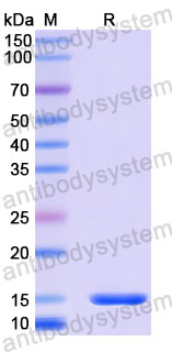 Валидация SDS-PAGE - AntibodySystem RHD10401