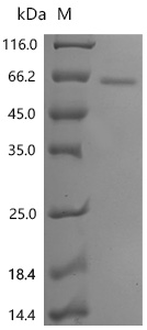 SDS-PAGE