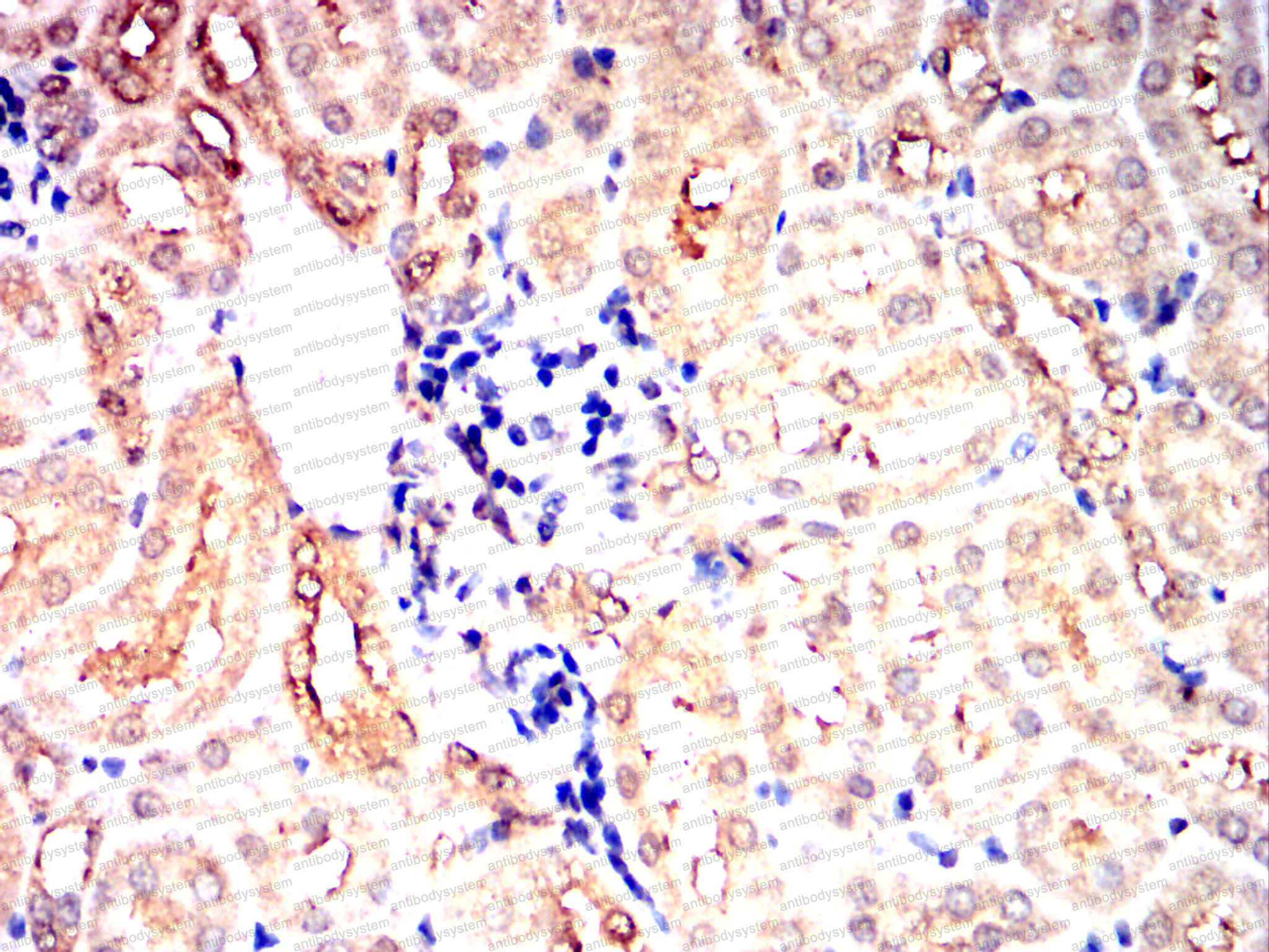 Валидация AntibodySystem RHF04003 (2433)