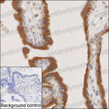 Валидация AntibodySystem RHE69002