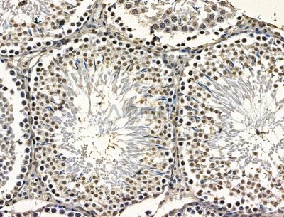 Валидация Affinity DF15253 - 11531