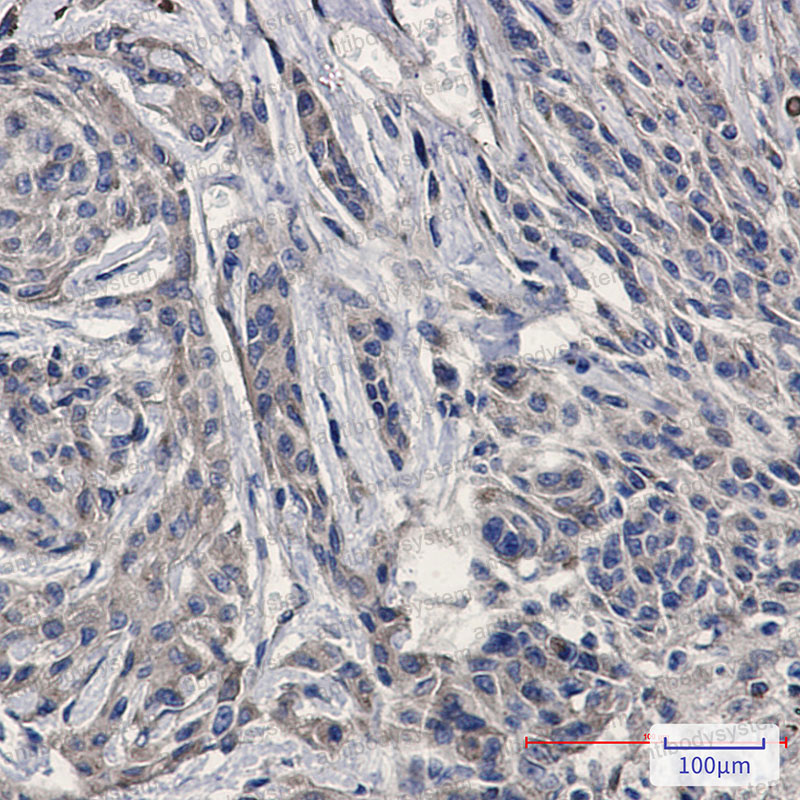 Валидация AntibodySystem RHC12514